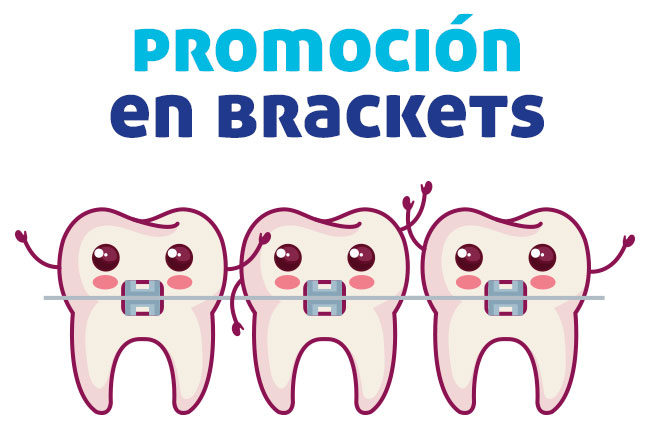 promo_brackets_dentalroom